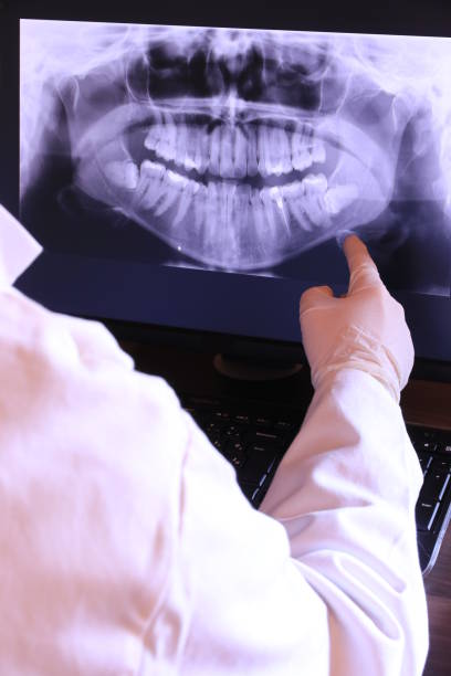 Best Broken or Chipped Tooth Repair in Rosebud, TX