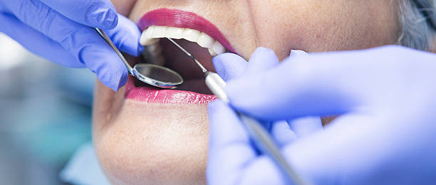 Best Emergency Wisdom Tooth Extraction in Rosebud, TX